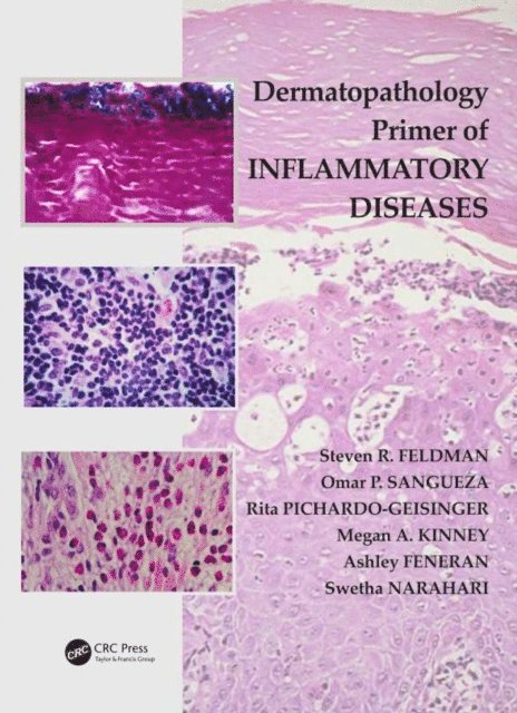 Swetha Narahari, Ashley Feneran, Megan Kinney, Rita Pichardo-Geisinger, Omar P. Sangueza, Steven R. Feldman - Dermatopathology Primer of Inflammatory Diseases, E-bok