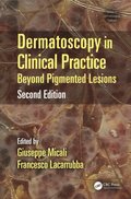 Dermatoscopy in Clinical Practice