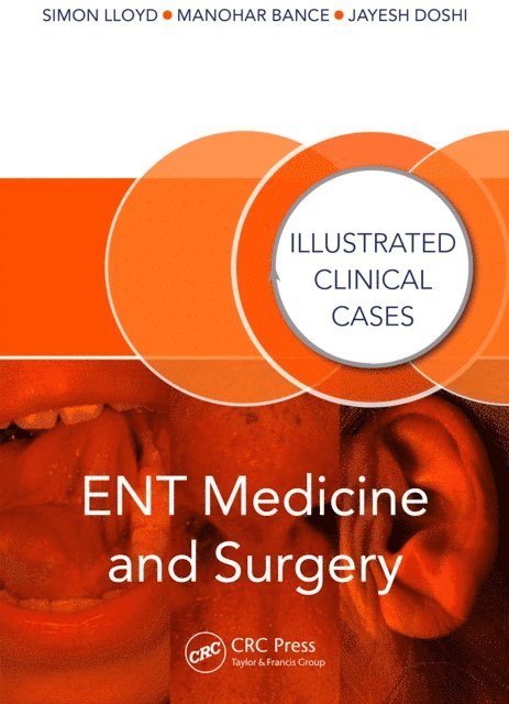 Simon Lloyd, Manohar Bance, Jayesh Doshi - ENT Medicine and Surgery, E-bok