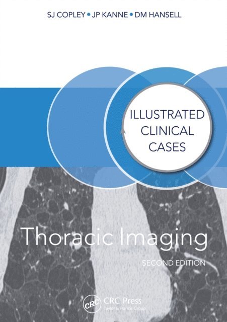 Jeffrey Kanne, David Hansell, Sue Copley - Thoracic Imaging, E-bok