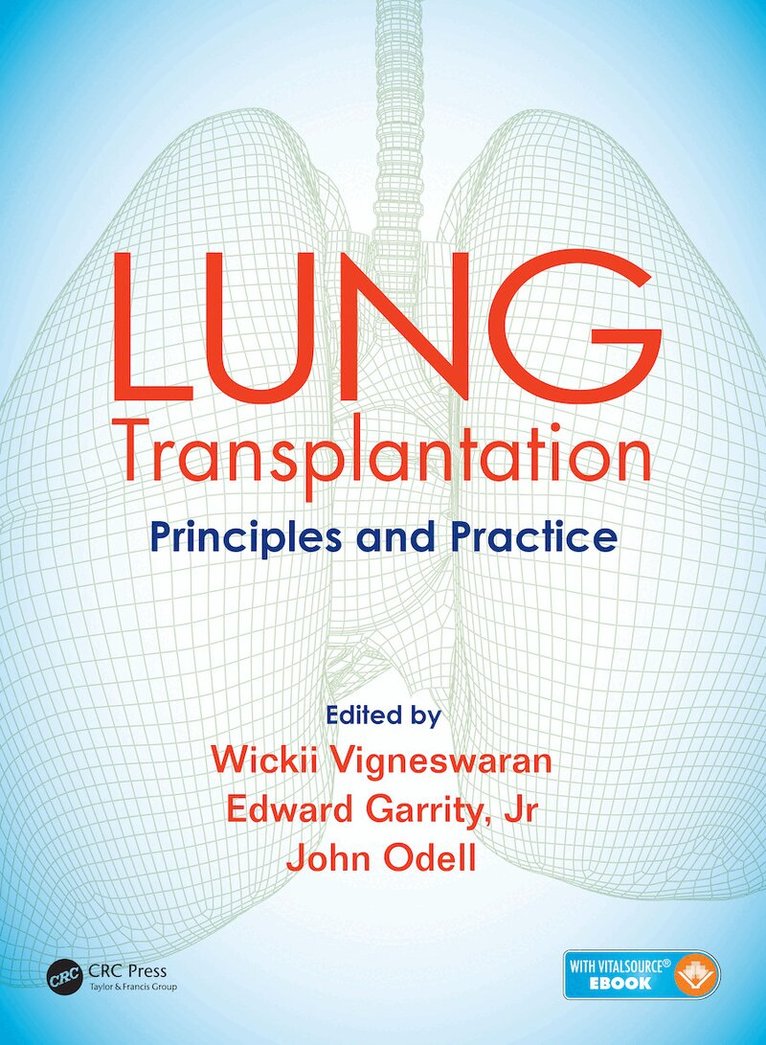 Wickii Vigneswaran, Edward Garrity, John Odell - Lung Transplantation, E-bok