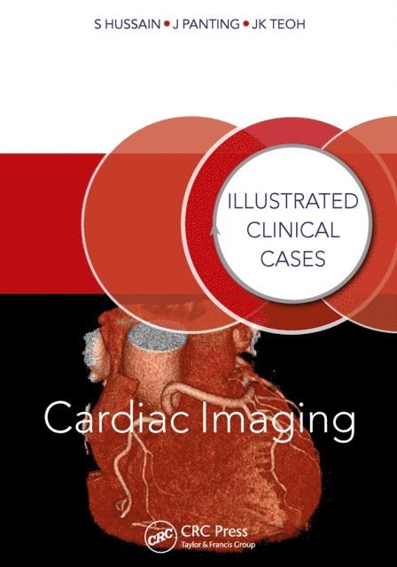 Jun Kiat Teoh, Jonathan Panting, Shahid Hussain - Cardiac Imaging, E-bok