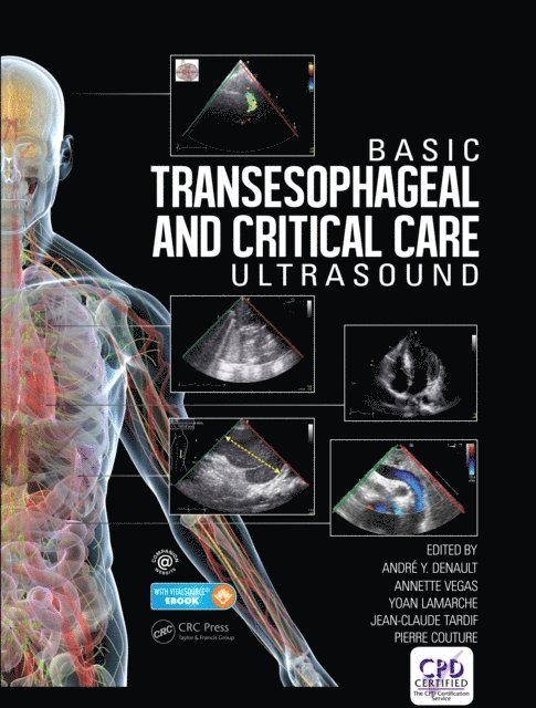 Pierre Couture, Jean-Claude Tardif, Yoan Lamarche, Annette Vegas, Andre Denault - Basic Transesophageal and Critical Care Ultrasound, E-bok