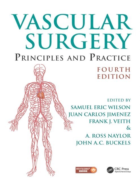 John A. C. Buckels, A. Ross Naylor, Frank J. Veith, Juan Carlos Jimenez, Samuel Eric Wilson - Vascular Surgery, E-bok