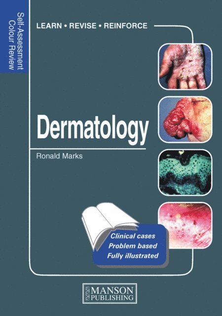 Ronald Marks - Dermatology, E-bok