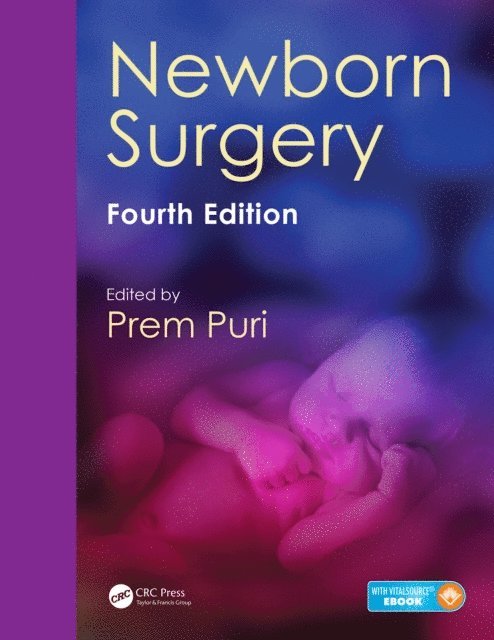 Prem Puri - Newborn Surgery, E-bok