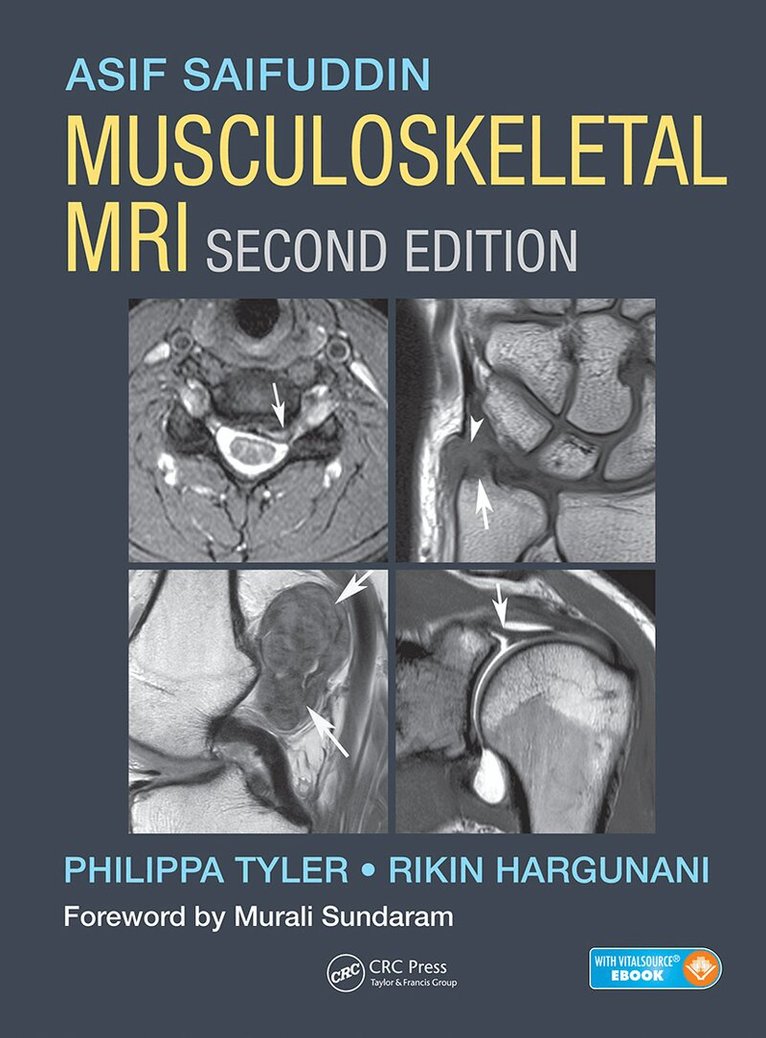 Asif Saifuddin, Philippa Tyler, Rikin Hargunani - Musculoskeletal MRI, Inbunden