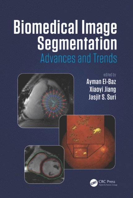 Jasjit S. Suri, Xiaoyi Jiang, Ayman El-Baz - Biomedical Image Segmentation, E-bok