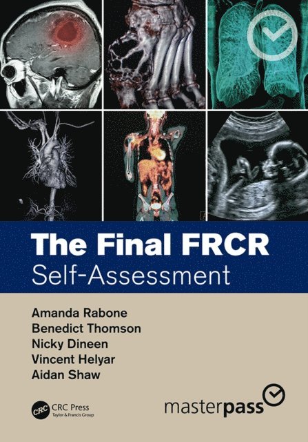 Aidan Shaw, Vincent Helyar, Nicky Dineen, Benedict Thomson, Amanda Rabone - Final FRCR, E-bok