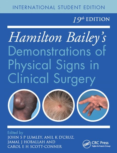 Carol E. H. Scott-Connor, Jamal K. Hoballah, Anil K. D'Cruz, John S. P. Lumley - Hamilton Bailey's Physical Signs, E-bok