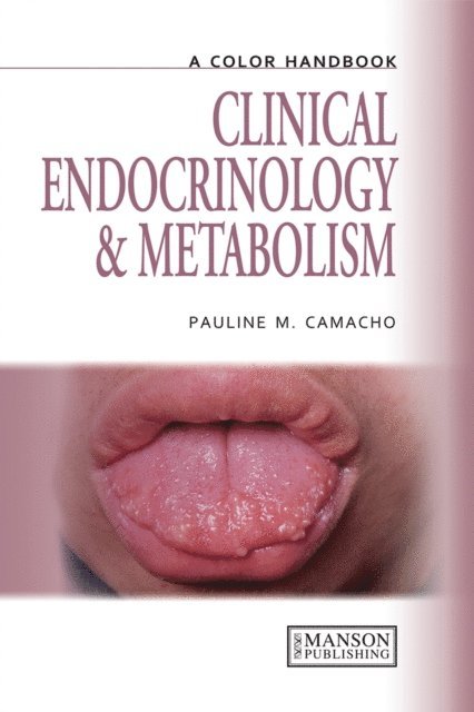 Pauline Camacho - Clinical Endocrinology and Metabolism, E-bok