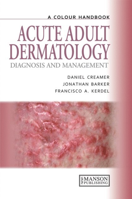 Francisco A. Kerdel, Jonathan Barker, Daniel Creamer - Acute Adult Dermatology, E-bok