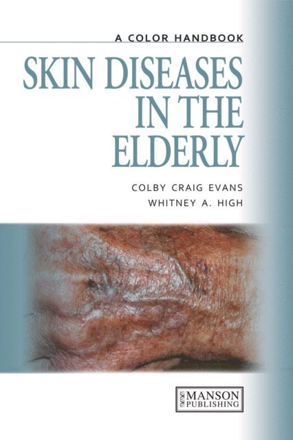 Whitney High, Colby Evans - Skin Diseases in the Elderly, E-bok