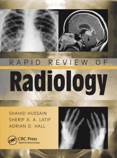 Adrian David Hall, Sherif Aaron Abdel Latif, Shahid Hussain - Rapid Review of Radiology, E-bok