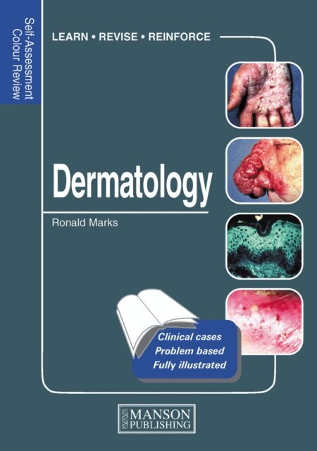 Ronald Marks - Dermatology, E-bok