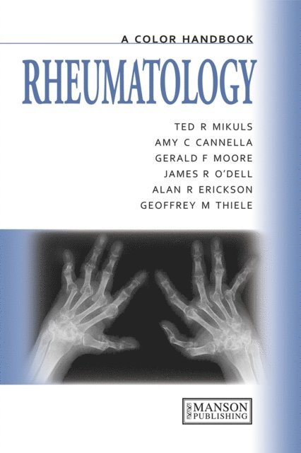 Geoffrey Thiele, Alan Erikson, James O'Dell, Gerald Moore, Amy Cannella, Ted Mikuls - Rheumatology, E-bok