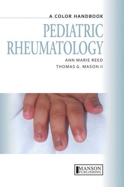 Thomas Mason, Anne Marie Reed - Pediatric Rheumatology, E-bok