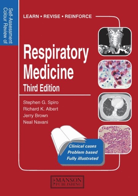 Neal Navani, Jerry Brown, Richard Albert, Stephen Spiro - Respiratory Medicine, E-bok