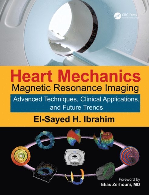 El-Sayed H. Ibrahim - Heart Mechanics, E-bok