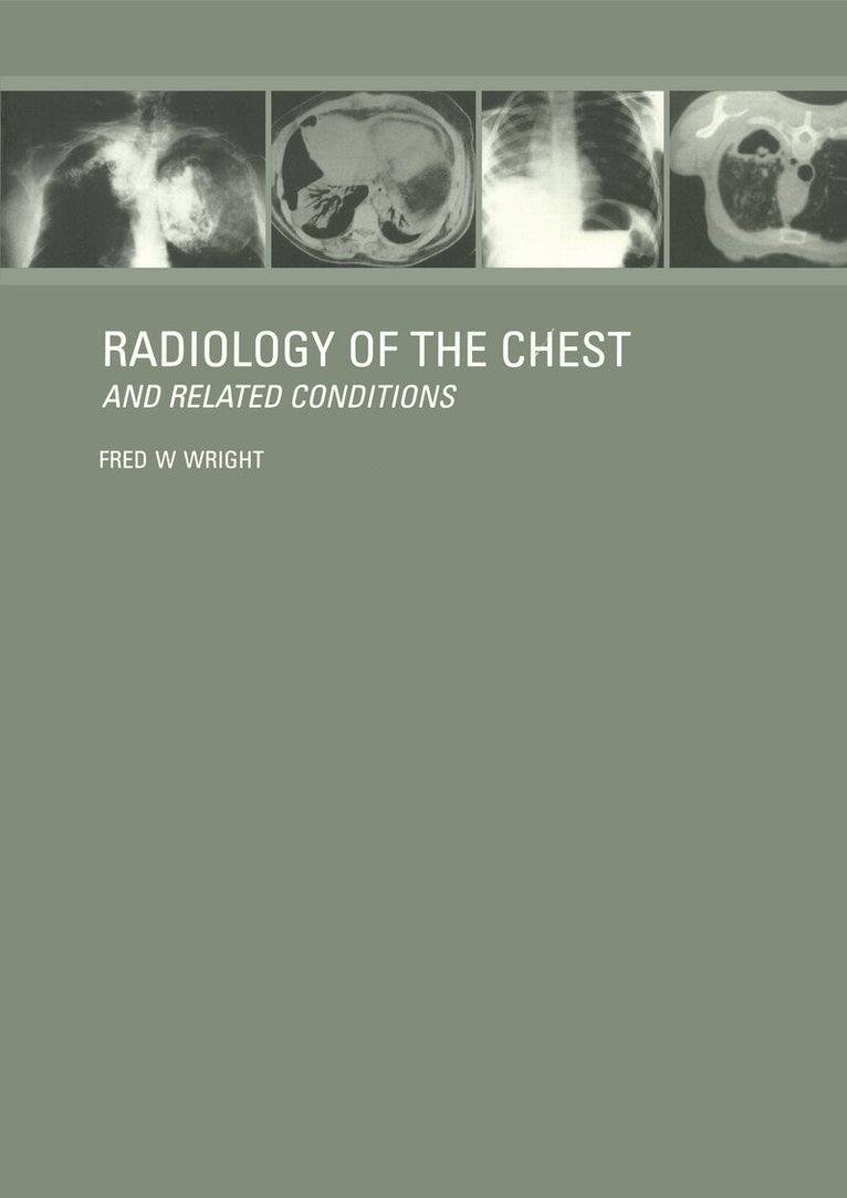 F W Wright - Radiology of the Chest and Related Conditions, E-bok