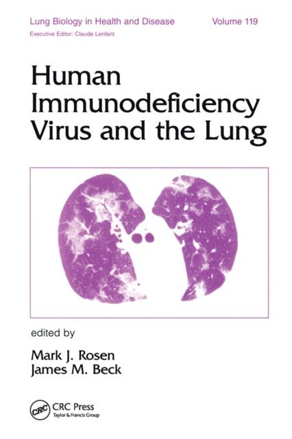 James M. Beck, Mark J. Rosen - Human Immunodeficiency Virus and the Lung, E-bok