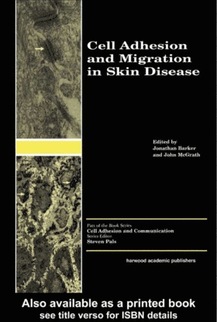 John McGrath, Jonathan Barker - Cell Adhesion and Migration in Skin Disease, E-bok