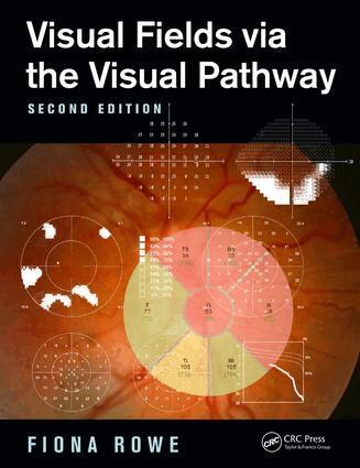 Fiona Rowe - Visual Fields via the Visual Pathway, Häftad. Tillgänglighet: Lägg i varukorg