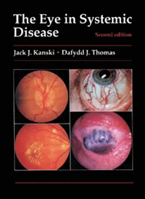 Dafydd J. Thomas, Jack J. Kanski - Eye in Systemic Disease, E-bok. Tillgänglighet: Lägg i varukorg