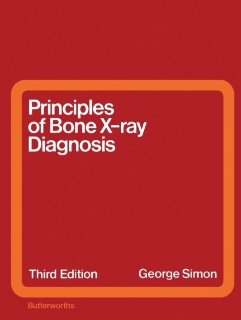 George Simon - Principles of Bone X-Ray Diagnosis, E-bok