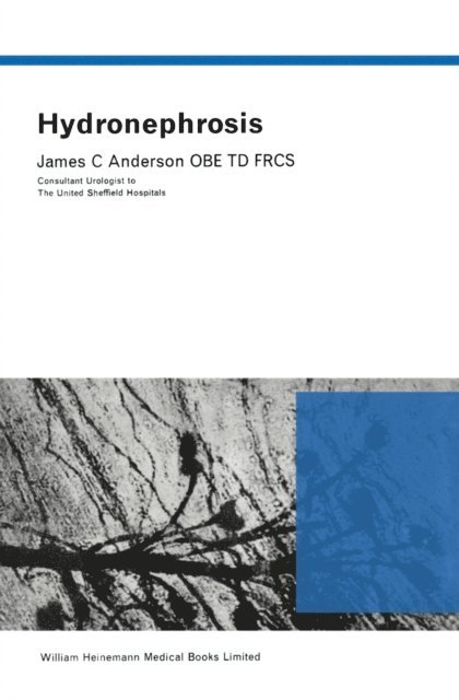 James C. Anderson - Hydronephrosis, E-bok
