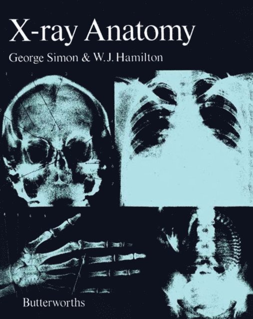 W. J. Hamilton, George Simon - X-Ray Anatomy, E-bok