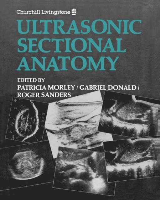 Roger C. Sanders, Gabriel Donald, Patricia Morley - Ultrasonic Sectional Anatomy, E-bok