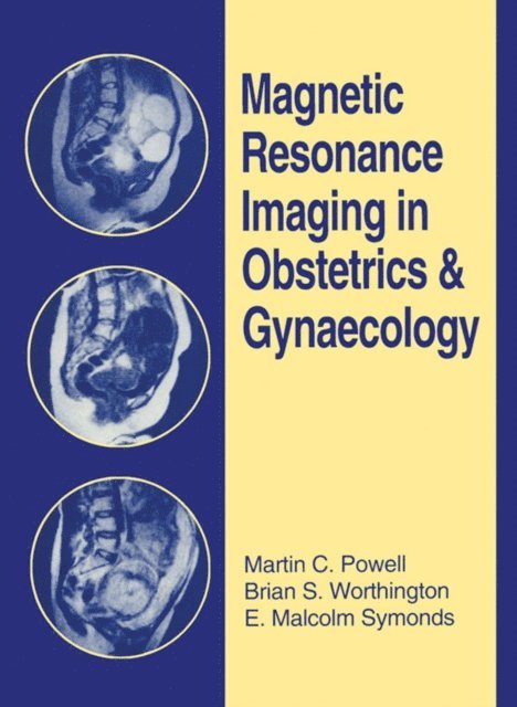 E. Malcolm Symonds, Brian S. Worthington, Martin C. Powell - Magnetic Resonance Imaging in Obstetrics and Gynaecology, E-bok