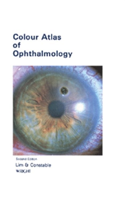 Ian J Constable, Arthur Lim Siew Ming - Colour Atlas of Ophthalmology, E-bok
