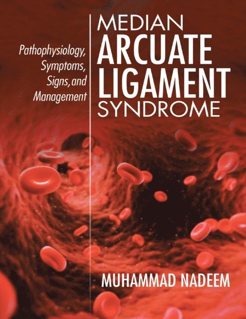 Muhammad Nadeem - Median Arcuate Ligament Syndrome: Pathophysiology, Symptoms, Signs, and Management, E-bok