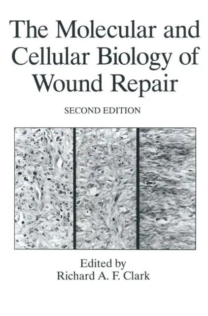 R.A.F. Clark - Molecular and Cellular Biology of Wound Repair, E-bok. Tillgänglighet: Lägg i varukorg