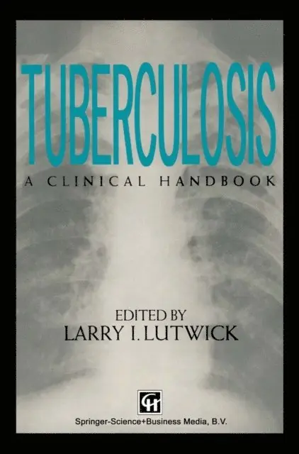 Larry Lutwick - Tuberculosis, E-bok. Tillgänglighet: Lägg i varukorg