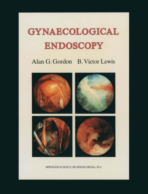 B. Victor Lewis, Alan G. Gordon - Gynaecological Endoscopy, E-bok
