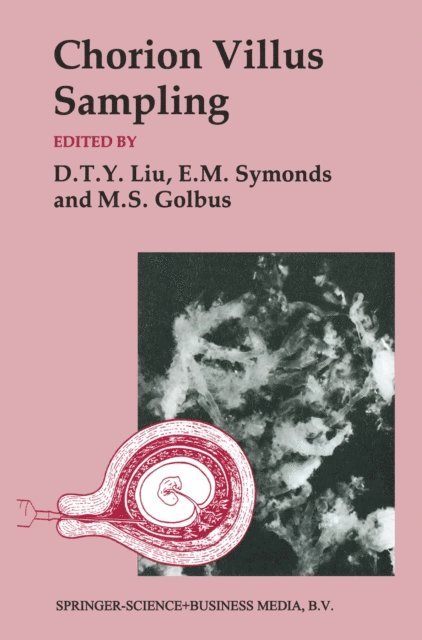 E. M. Symonds, D. T. Y. Liu, Mitchell S. Golbus - Chorion Villus Sampling, E-bok. Tillgänglighet: Lägg i varukorg