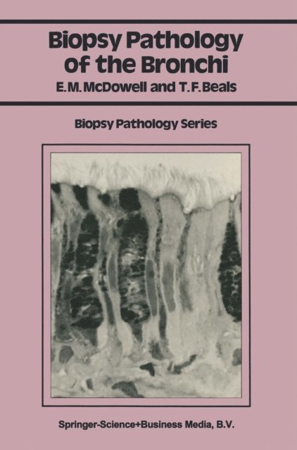 Theodore F. Beals, Elizabeth M. McDowell - Biopsy Pathology of the Bronchi, E-bok