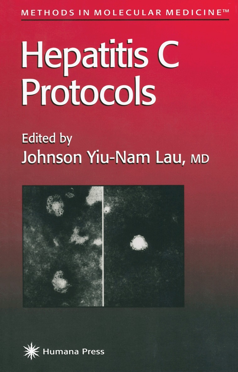 Johnson Y. N. Lau - Hepatitis C Protocols, Häftad. Tillgänglighet: Lägg i varukorg
