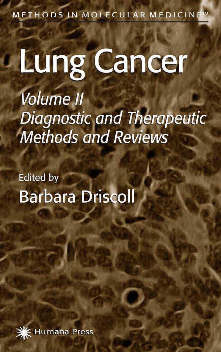 Barbara Driscoll - Lung Cancer, Häftad