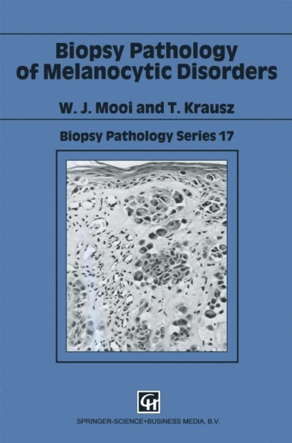 T. Krausz, W. J. Mooi - Biopsy Pathology of Melanocytic Disorders, E-bok