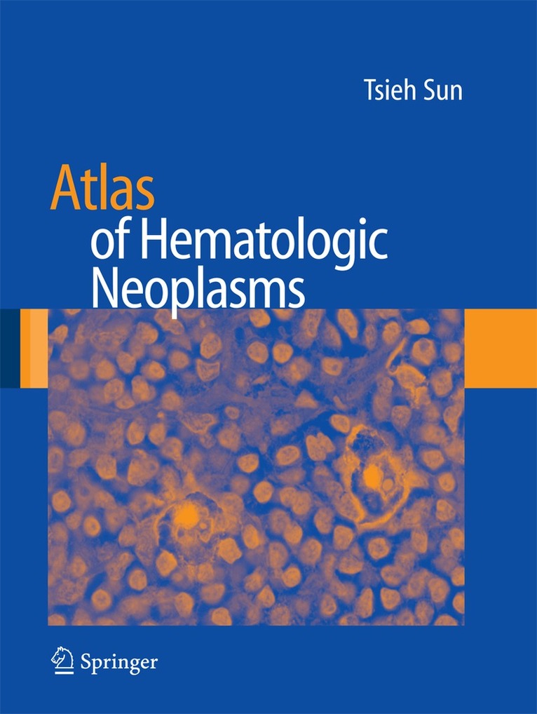 Atlas of Hematologic Neoplasms