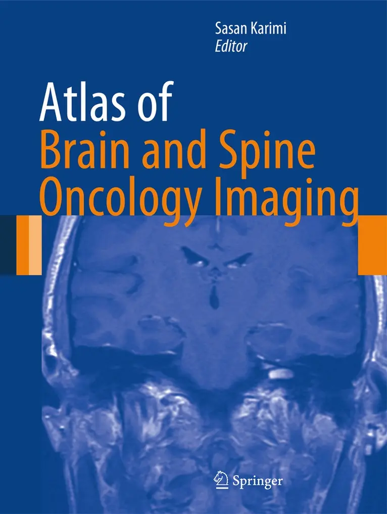 Sasan Karimi - Atlas of Brain and Spine Oncology Imaging, Häftad. Tillgänglighet: Lägg i varukorg