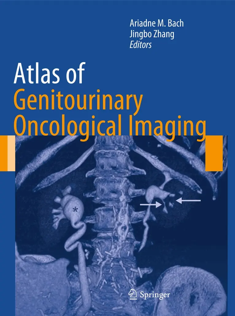 Ariadne M Bach, Jingbo Zhang - Atlas of Genitourinary Oncological Imaging, Häftad. Tillgänglighet: Lägg i varukorg