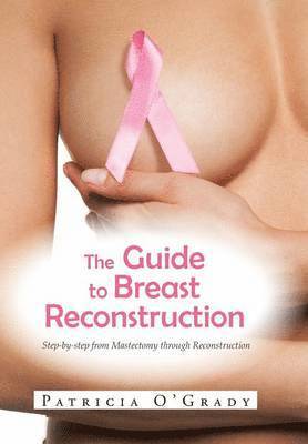 Patricia O'Grady - Guide to Breast Reconstruction, Inbunden. Tillgänglighet: Lägg i varukorg
