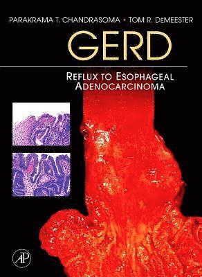 Parakrama T. Chandrasoma, Tom R. Demeester - Gerd: Reflux to Esophageal Adenocarcinoma, Häftad. Tillgänglighet: Lägg i varukorg