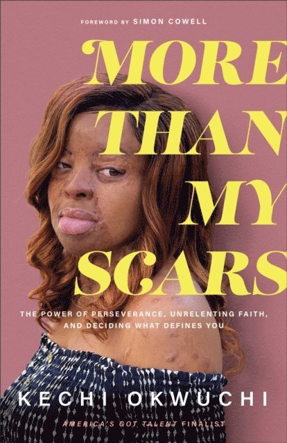 Kechi Okwuchi - More Than My Scars, E-bok