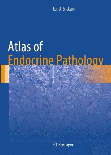 Lori A. Erickson - Atlas of Endocrine Pathology, E-bok